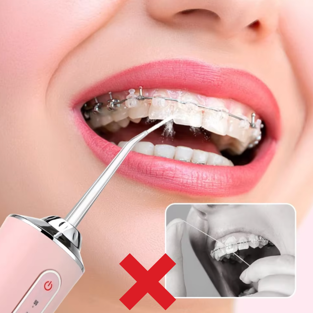 AquaPulse - Cordless Water Flosser